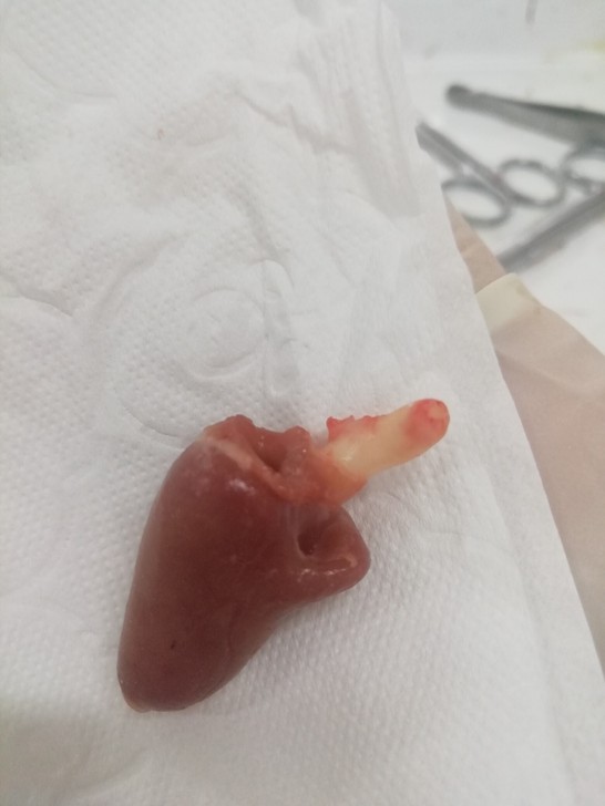 雏鸡心脏标本，树脂标本